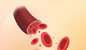 起床后4种表现提示血脂超标